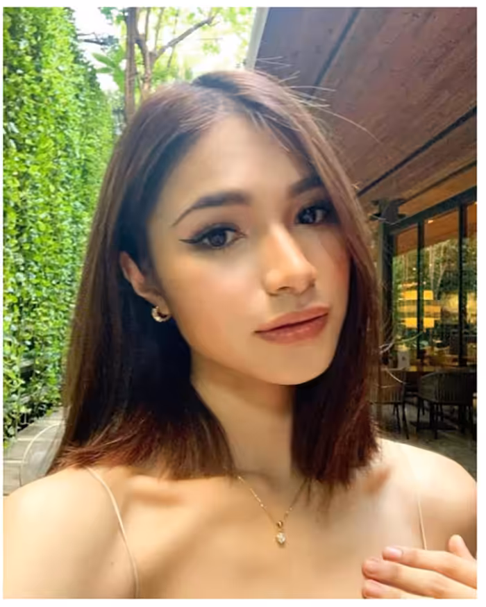 ริมฝีปากอวบอิ่ม แบบสาวสายฝอ ด้วยการเติมฟิลเลอร์ริมฝีปาก ให้ดูสวยน่าจุมพิต