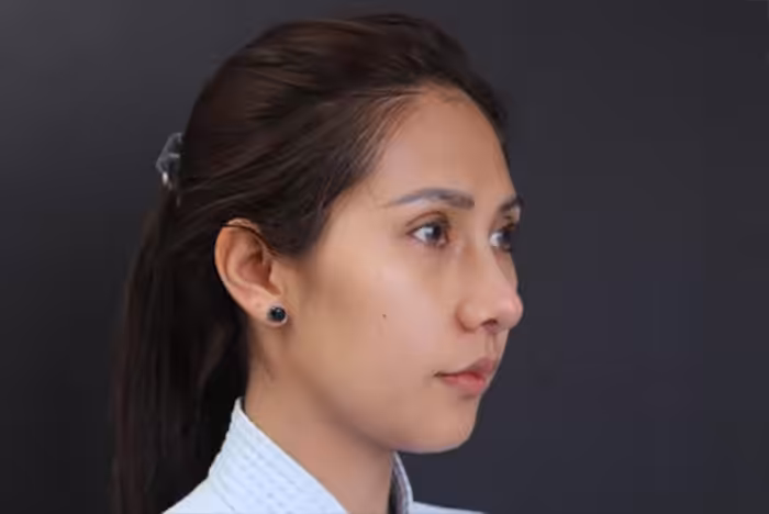 Sunken eyes and dark under-eyes making the face look tired