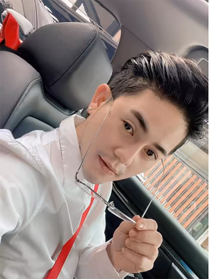 ผลลัพธ์หลังขูดซิลิโคนเหลวและเสริมคางใหม่ ใบหน้าดูเรียวยาวสมส่วน