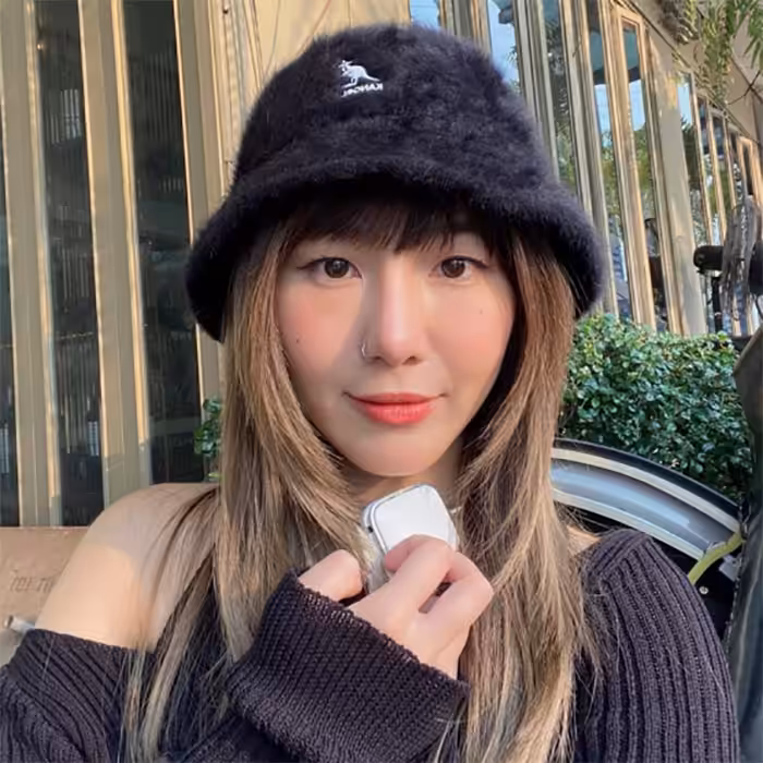 เติมริมฝีปากให้อวบอิ่ม ยกมุมปากให้มีรอยยิ้มเล็กๆ แบบไม่ต้องผ่าตัด ด้วยการฉีดฟิลเลอร์ให้ริมฝีปากสวยแบบสาวสายฝอที่ “The Art”