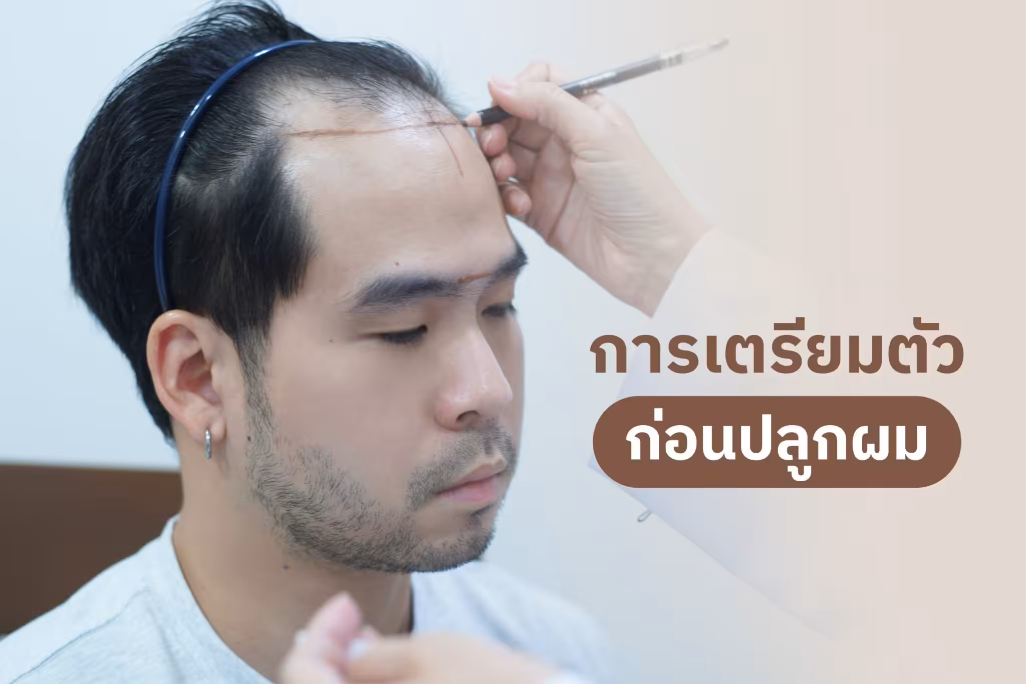 การเตรียมตัวก่อนเข้ารับการฟื้นฟูเส้นผม