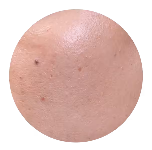 Skin before the Diamond Baby Face program