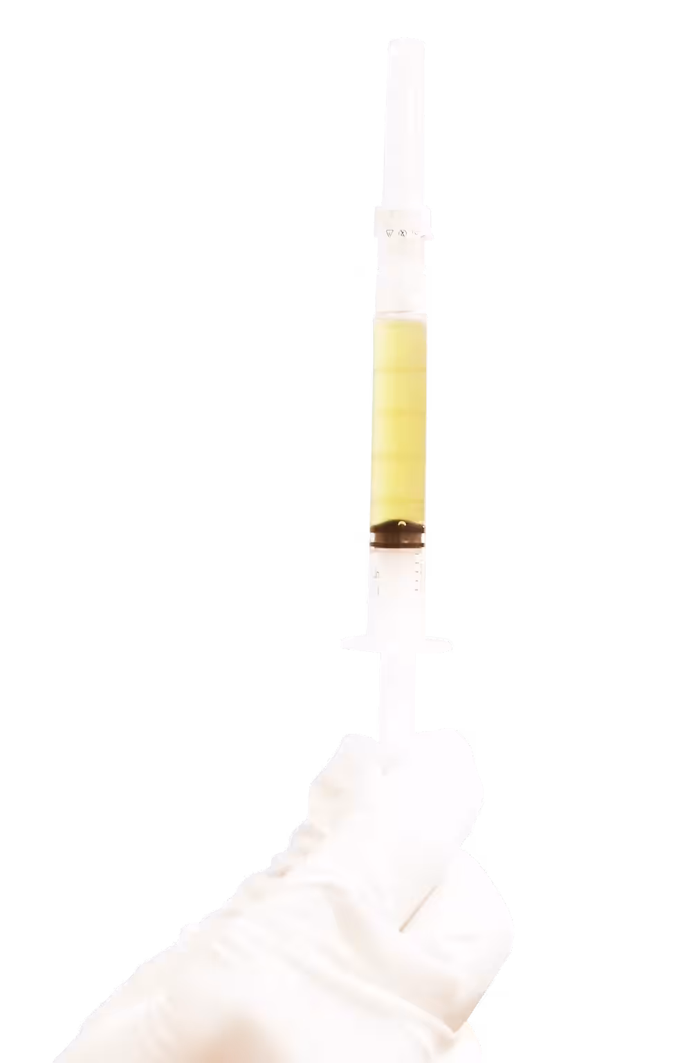 PRP syringe used in the Diamond Baby Face program