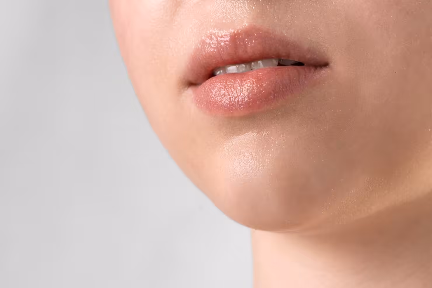 Lip filler vs surgery