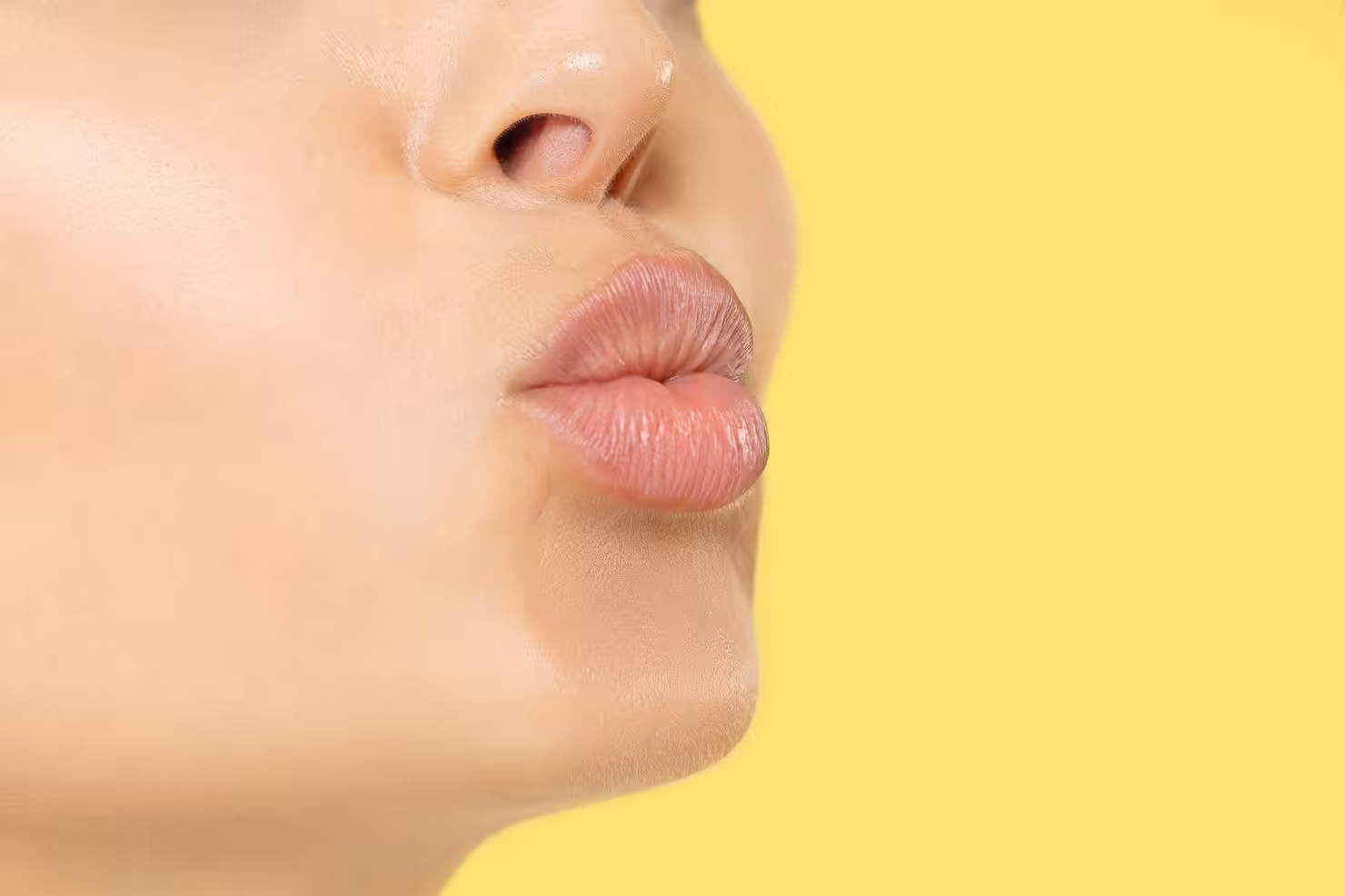 What lip filler is