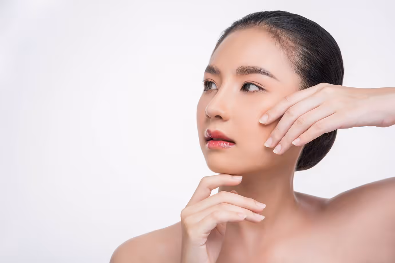 After nasolabial fold filler injections