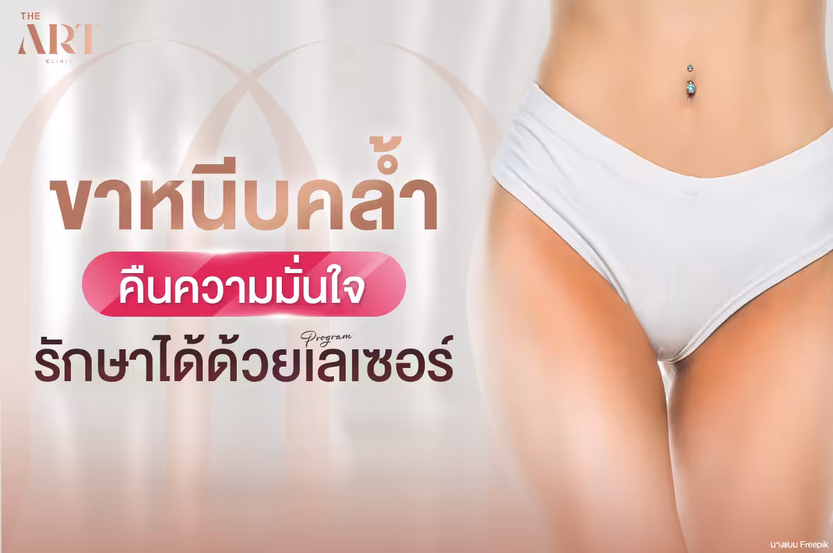 การดูแลและรักษาปัญหาที่ขาหนีบ: จากความคล้ำถึงการรักษาด้วยเลเซอร์