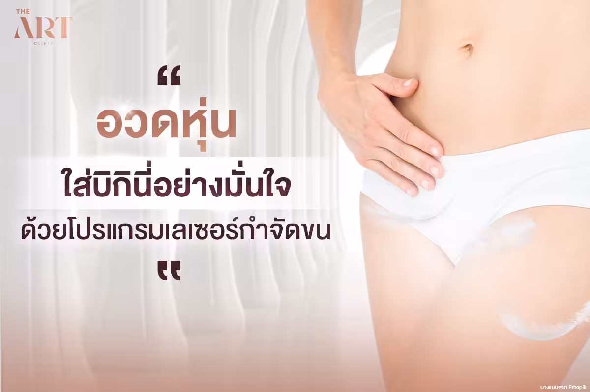 เจาะลึกการกำจัดขนด้วยเลเซอร์บิกินี่: วิธีทันสมัยสำหรับผิวเรียบเนียน
