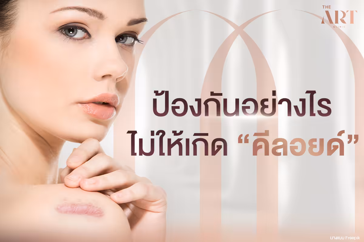 ปัญหาคีลอยด์: วิธีดูแลตัวเองเพื่อป้องกัน