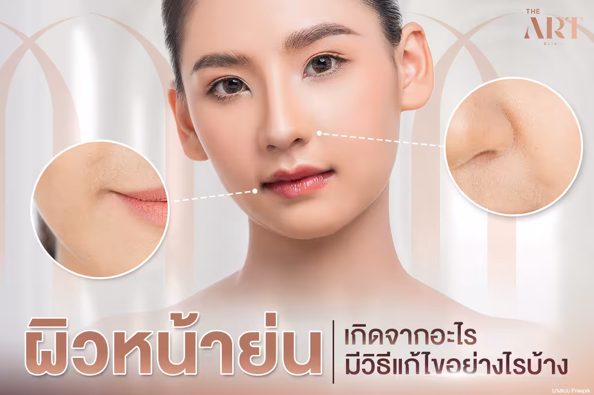 วิธีแก้ไขปัญหาหน้าย่น: สาเหตุและเทคนิคการรักษา