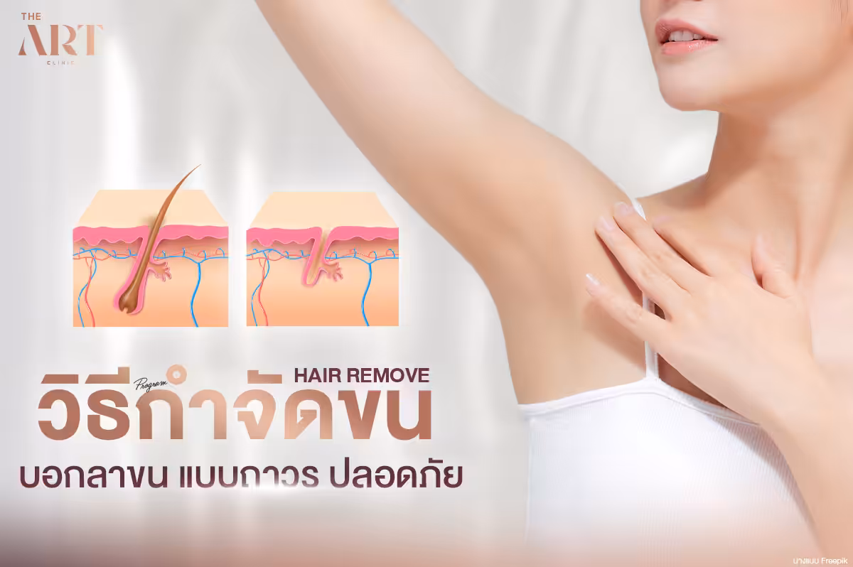 เทคนิคและวิธีการกำจัดขน: ทางเลือกและราคา