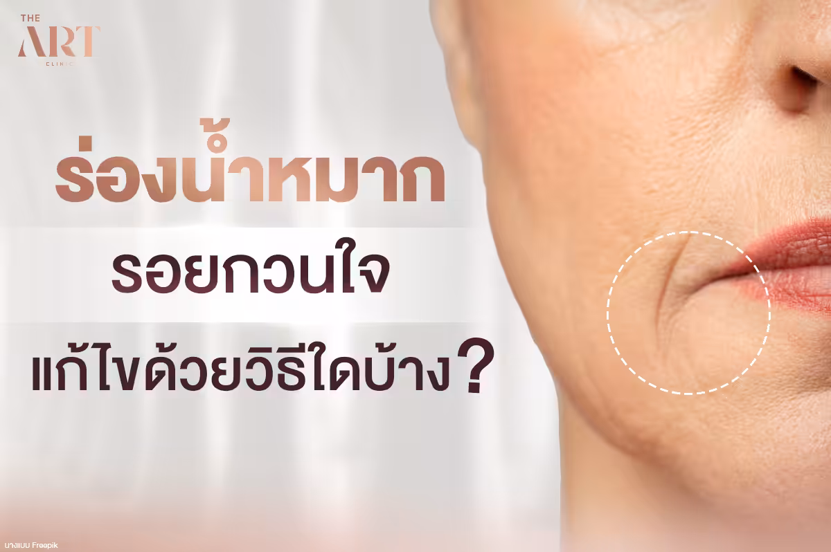 ร่องน้ำหมาก: รอยกวนใจที่บ่งบอกถึงอายุ แก้ไขได้ด้วยวิธีใดบ้าง?