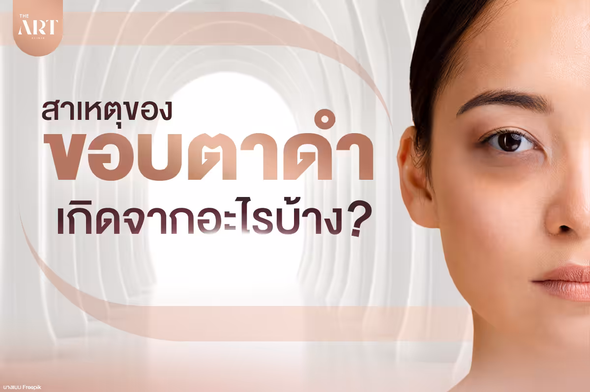 ปัญหาขอบตาดำ: สาเหตุ อาการ และวิธีแก้ไข