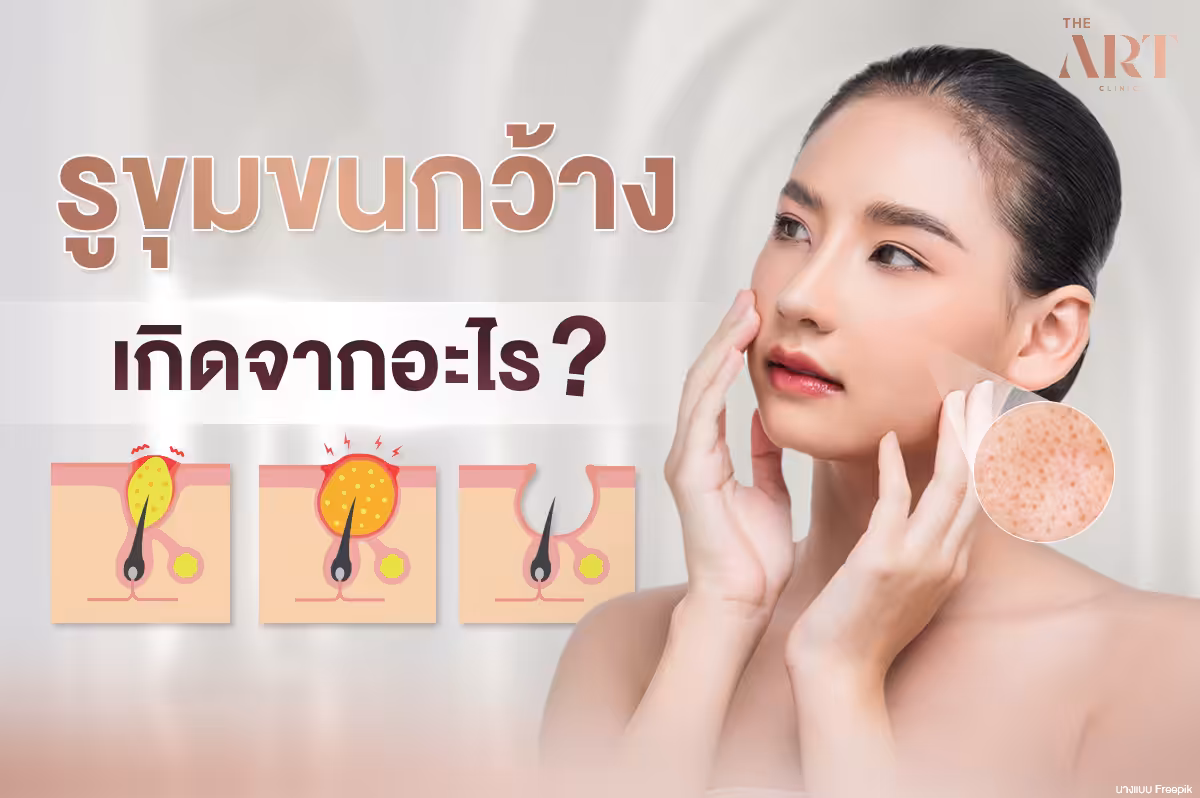 ทำความเข้าใจกับปัญหารูขุมขนกว้าง