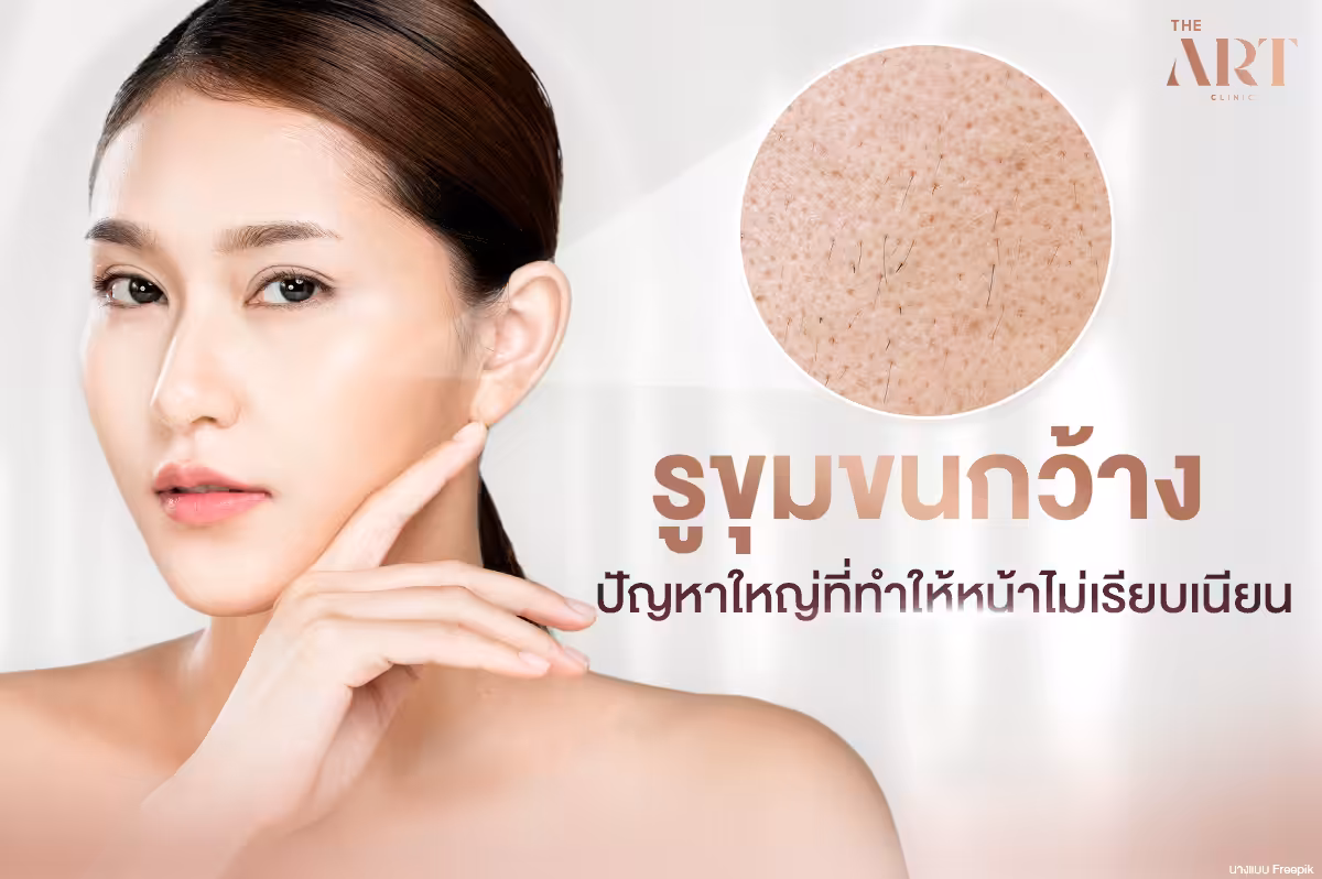 ปัญหารูขุมขนกว้าง: สาเหตุ การรักษา และวิธีการเลือกผลิตภัณฑ์ที่เหมาะสม