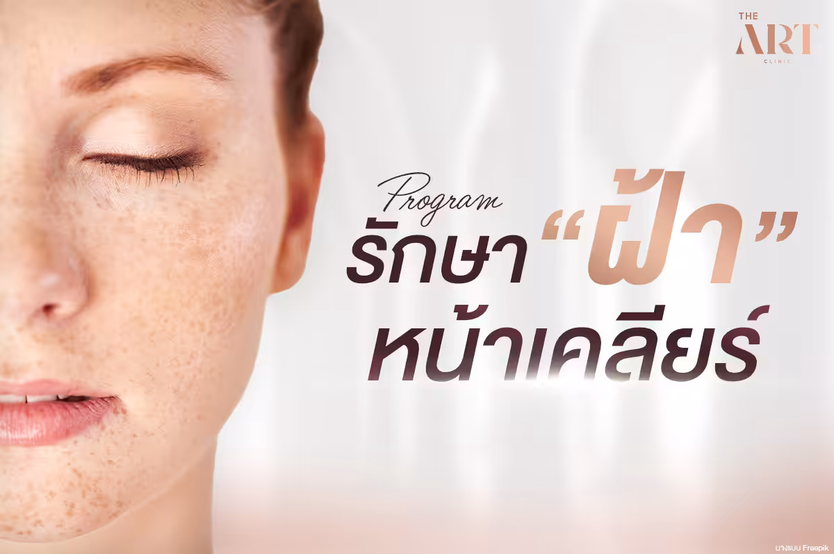 รักษาฝ้าหายขาดได้จริง! เผยเคล็ดลับรักษาฝ้าให้หน้าใส หมดปัญหาฝ้า–กระ
