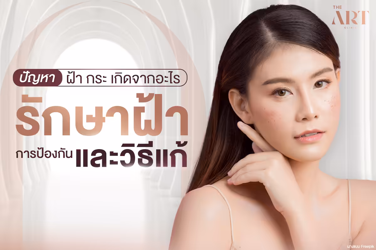 ปัญหาฝ้ากระ: สาเหตุ การป้องกัน และวิธีการรักษาที่มีประสิทธิภาพ