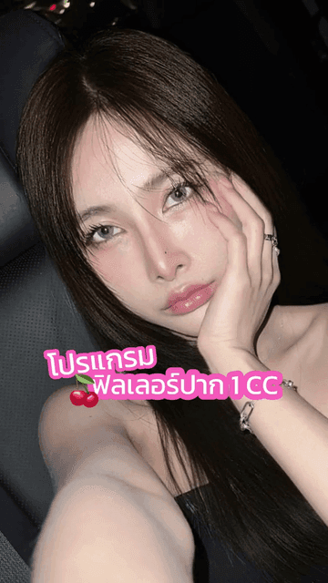 รีวิวฉีดฟิลเลอร์